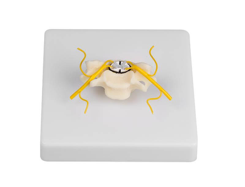 Halswirbel mit Rückenmark im Querschnitt – Mit Darstellung der Spinalnerven - Erler - Zimmer